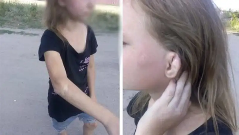 Приютившая девочку-инвалида алматинка не собирается примиряться с ее матерью