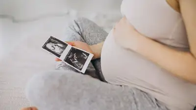 беременность, фото - Новости Zakon.kz от 07.09.2023 18:33