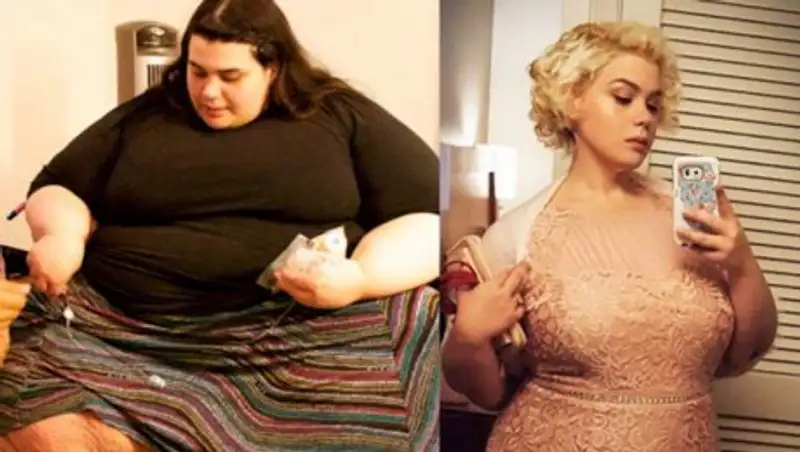 Невероятные фотографии до и после похудения