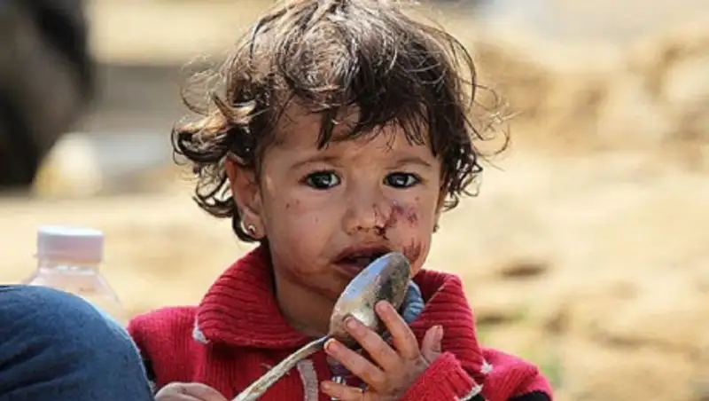 ООН: на 10 тыс. больше детей умирают каждый месяц из-за усугубленного пандемией голода