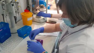 анализы, фото - Новости Zakon.kz от 27.06.2022 23:40