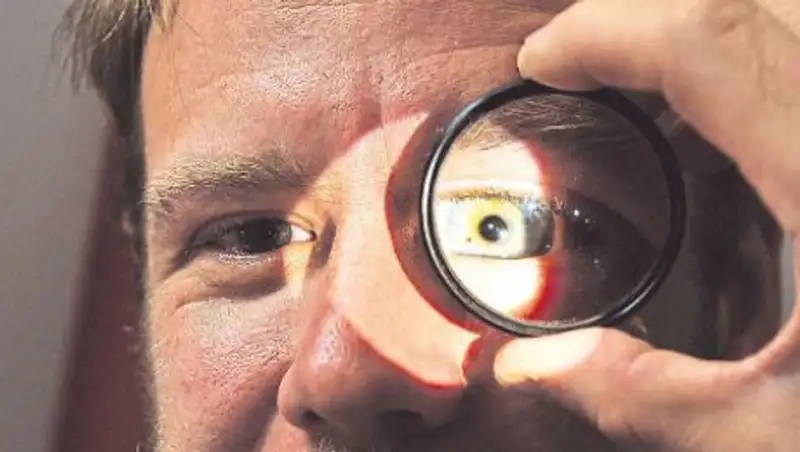 Что приводит к кровоизлиянию в глаза