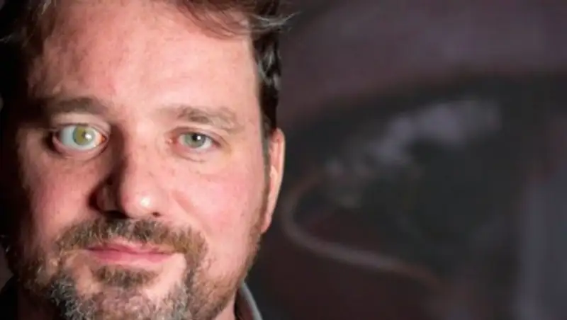 Канадец удалил глаз, чтобы установить камеру