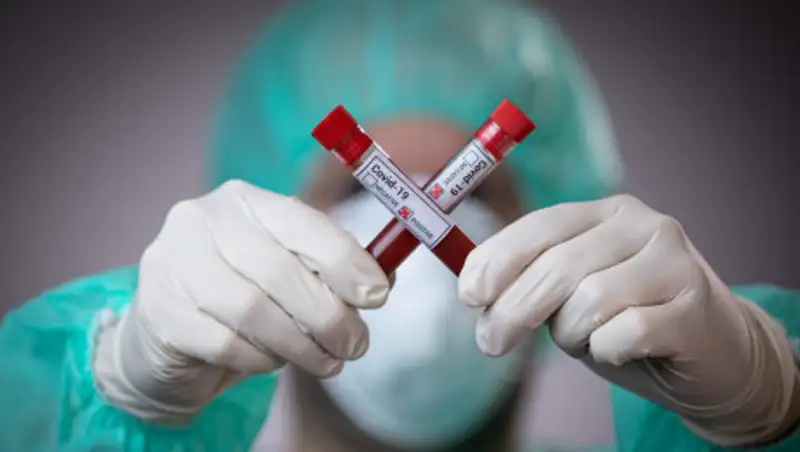 Врач рассказала, почему мужчины переносят COVID-19 тяжелее женщин