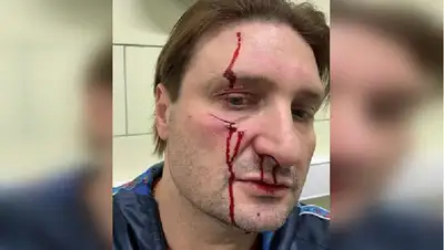 Запашный, тигр, ранение, фото - Новости Zakon.kz от 19.11.2022 07:47