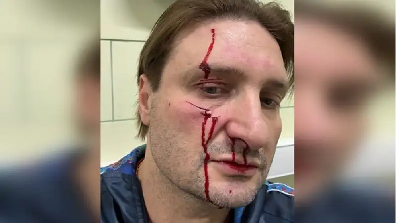 Эдгард Запашный вернулся к тренировкам с ранившим его тигром