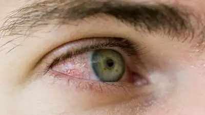 likarni.com, фото - Новости Zakon.kz от 13.02.2019 15:04