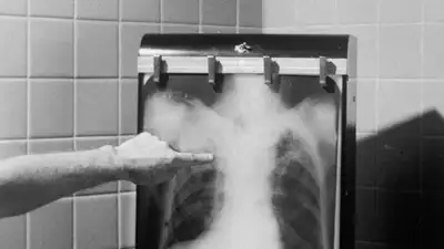 Туберкулез выявили у сотрудника детсада в Петропавловске, фото - Новости Zakon.kz от 06.10.2023 14:44