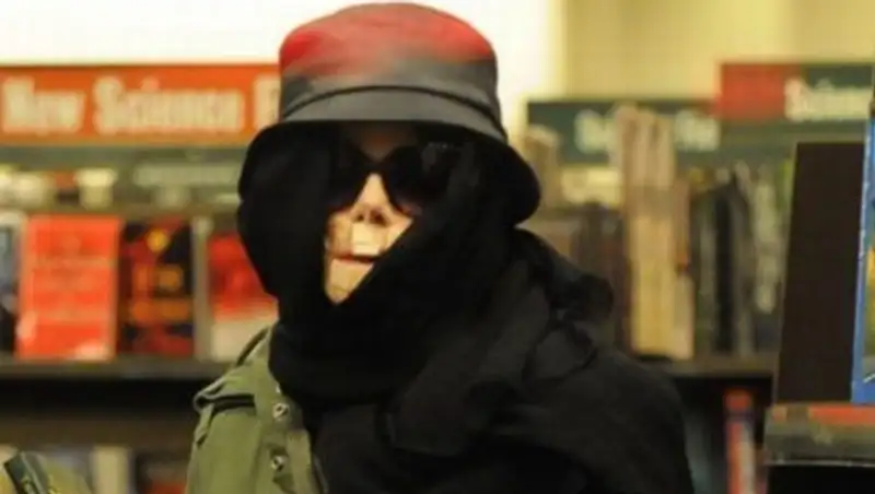 Зачем Майкл Джексон носил маску и клеил пластырь на нос