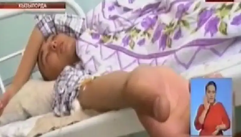 Число отравившихся военнослужащих в Кызылорде достигло 47 человек