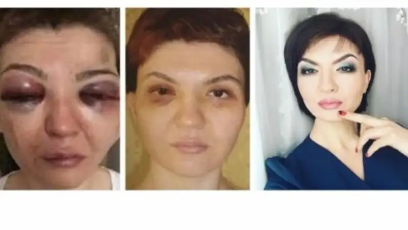 Казахстанка рассказала, как избавилась от синяков, тирана-мужа и глупых иллюзий