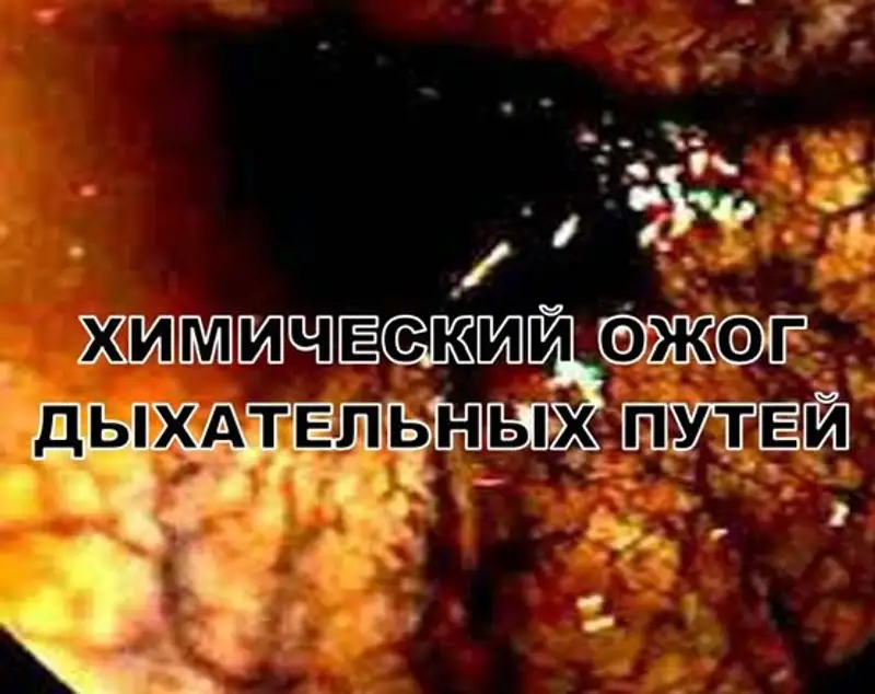 На казахстанских вейпах появятся страшные картинки о вреде курения, фото - Новости Zakon.kz от 20.02.2023 16:13