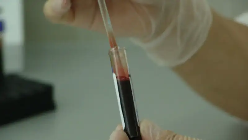 В ряде стран минимальные показатели по коронавирусу