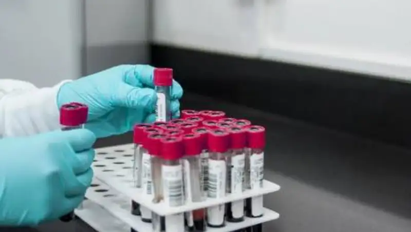 Вторая отечественная вакцина от КВИ прошла первую фазу исследований