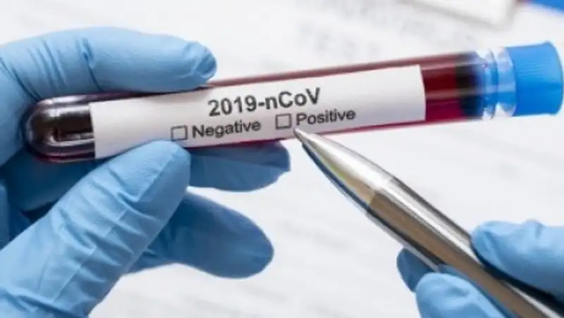 О текущей ситуации по коронавирусу в Жамбылской области