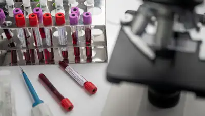 Pixabay, фото - Новости Zakon.kz от 02.07.2020 21:12