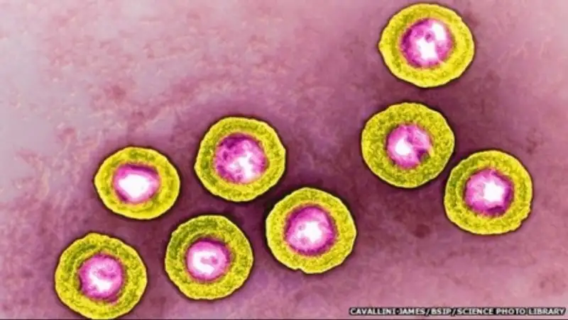 Вирус герпеса может применяться для лечения рака кожи
