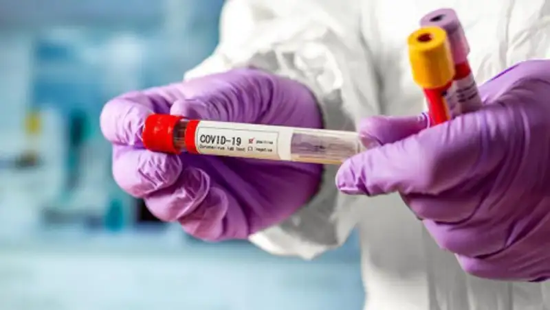 В Казахстане 161 человек выздоровел от COVID-19