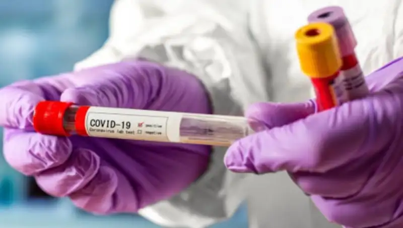 Еще 15 казахстанцев заразились коронавирусом