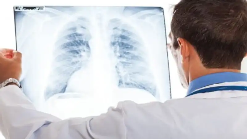 Солдат умер от туберкулезного менингита в Атырау