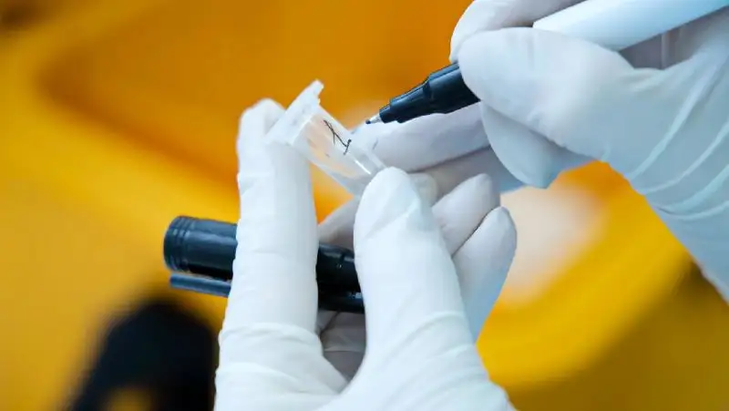 12 казахстанцев заболели COVID-19 за сутки