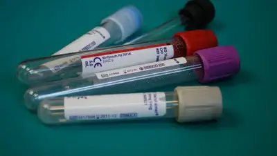 Pixabay, фото - Новости Zakon.kz от 13.05.2020 19:39