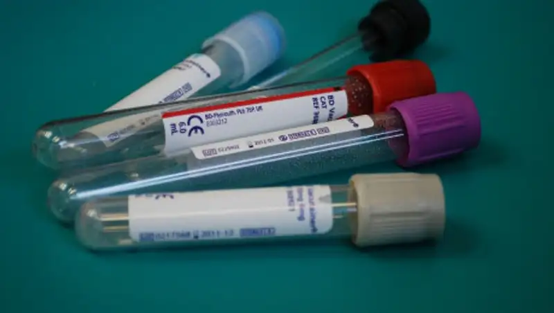 В Таджикистане число зараженных коронавирусом превысило 800