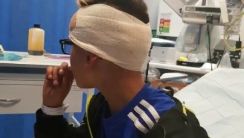 Подростки прибили доску к голове мальчика-аутиста, который отстал от родителей