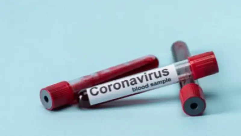 В Алматы расширяют категории обследуемых на коронавирус людей