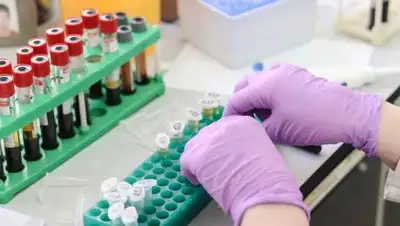 Pixabay.com, фото - Новости Zakon.kz от 25.08.2021 08:00