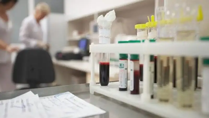 НЯЦ: Гамма-излучающих нуклидов у жителей села Калачи не обнаружено