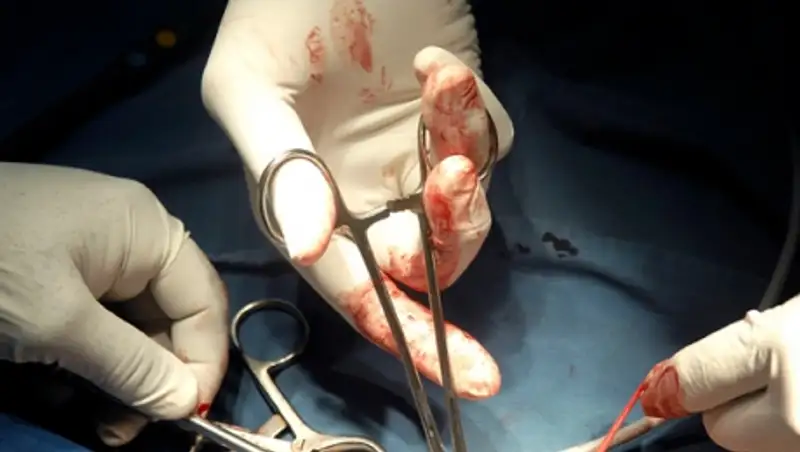 Мужчина с ножницами в голове поразил врачей