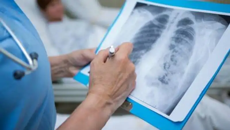 За сутки выявили 242 больных коронавирусной пневмонией в Казахстане