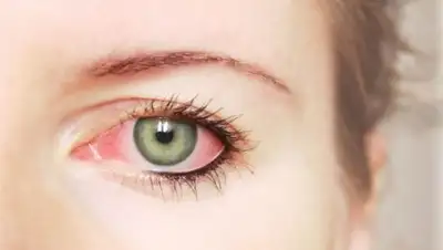 из открытых источников, фото - Новости Zakon.kz от 26.01.2019 18:35