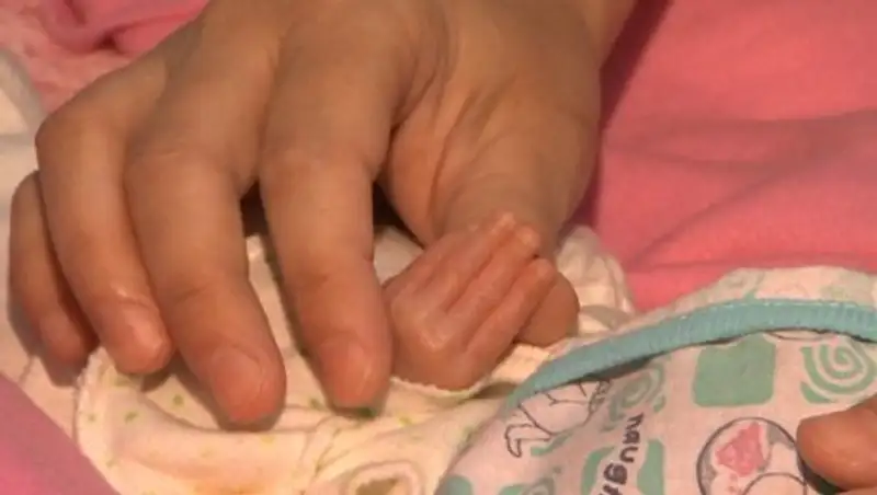 Почти 500 недоношенных детей родились в Алматы в 2018 году