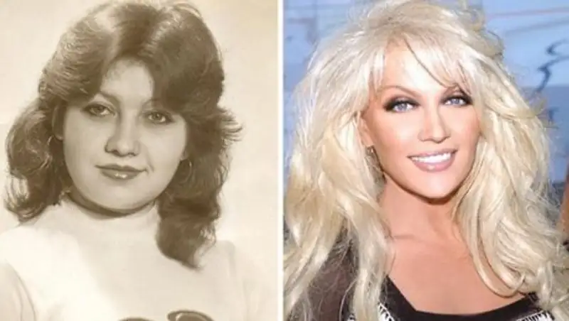 10 звезд, которые должны сказать спасибо своему пластическому хирургу