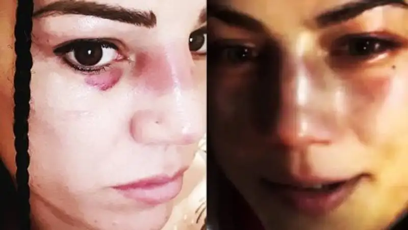 Ева Вальстрем назвала предстоящий бой с Фирузой Шариповой "битвой сломанных носов"