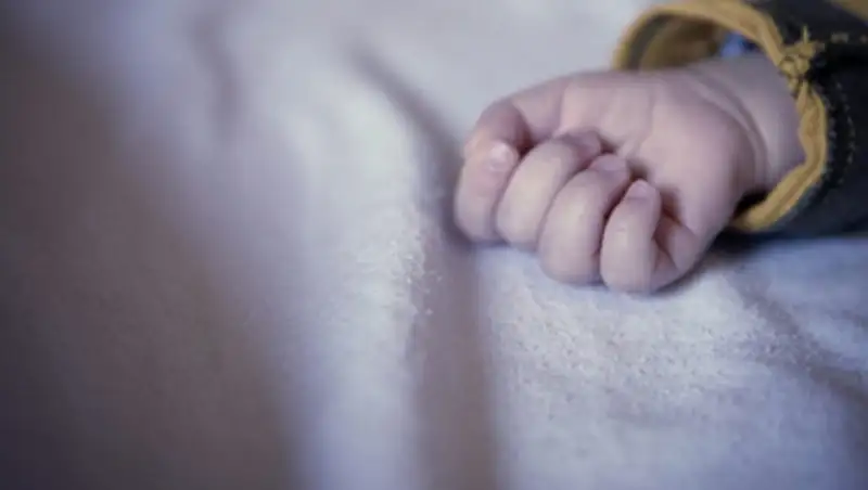 Ребенок-русалка родился в Индии