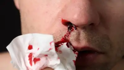 Zakon.kz, фото - Новости Zakon.kz от 03.04.2017 17:56