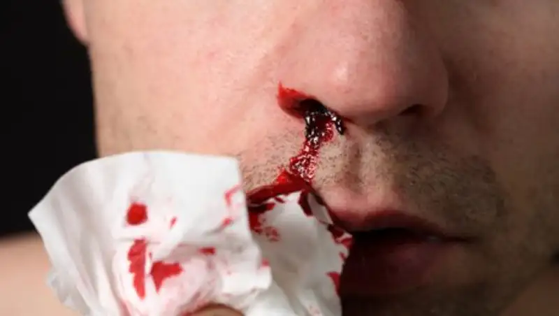 Жителя Уральска осудили за разбитый нос полицейского