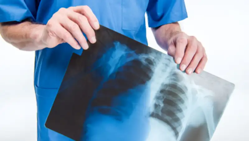 Почему ранее выявленные пневмонии не войдут в новую статистику с 1 августа