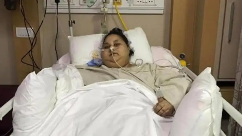 Самая тяжелая женщина в мире похудела вдвое