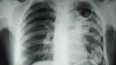 wikimedia.org, фото - Новости Zakon.kz от 25.02.2021 17:02