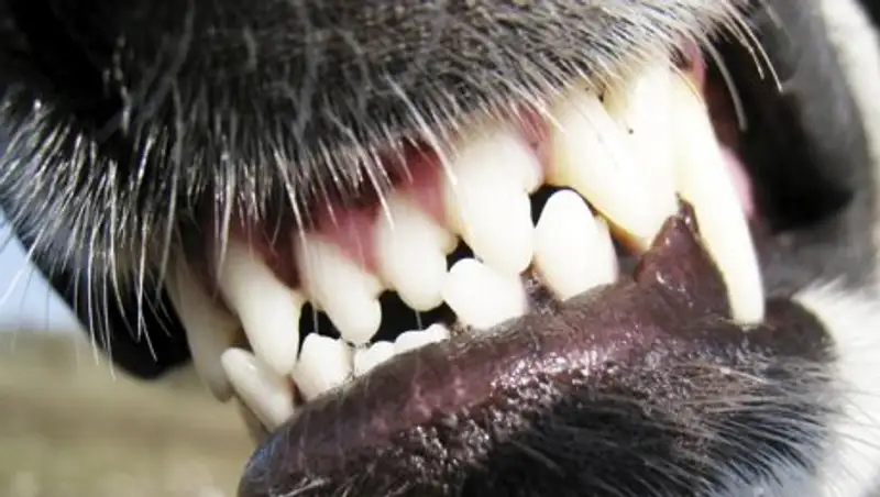 Костанайские медики рассказали подробности смертельного нападения собаки на мужчину