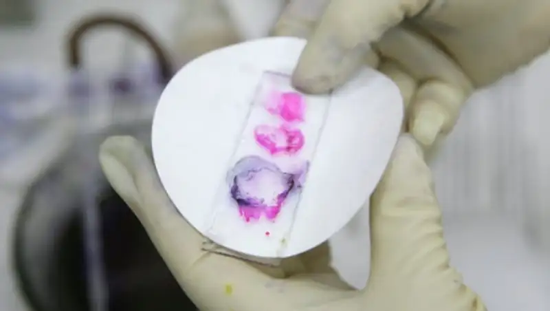 Немецкие СМИ: США использовали споры сибирской язвы на учениях в ФРГ