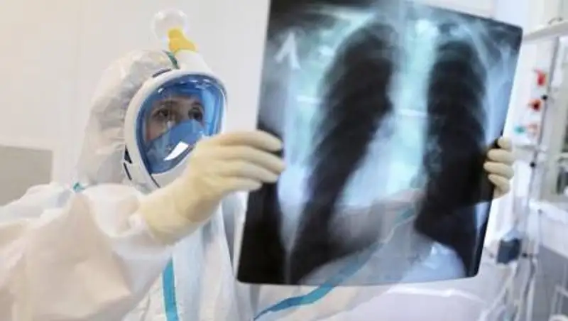 176 казахстанцев заболели пневмонией за сутки