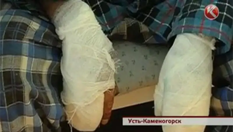 В Усть-Каменогорске треть пациентов с обморожением – автомобилисты