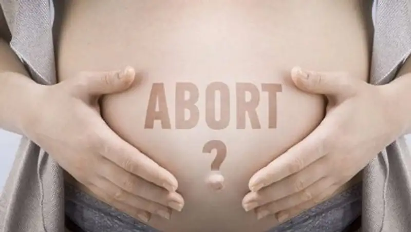 В Казахстане предложили запретить аборты
