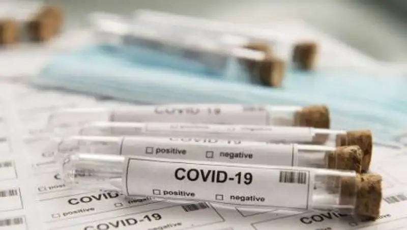 В ВКО объяснили, почему образовались очереди у ПЦР-лабораторий