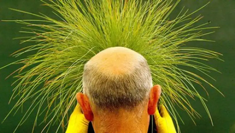 Назван способ предотвратить облысение